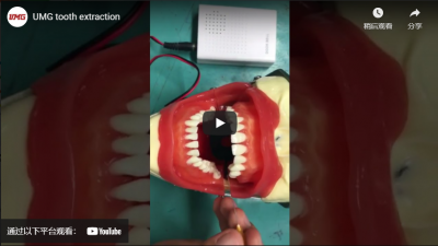 Extracción de dientes en UMG
    robot