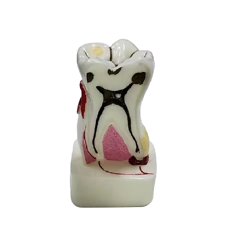 Modelo de perfil anatómico UM-AA1 del molar mandibular (6 veces el tamaño natural)
   