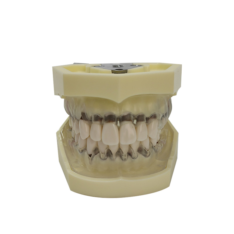 UM-4028 Modelo periodontal con encía transparente
   