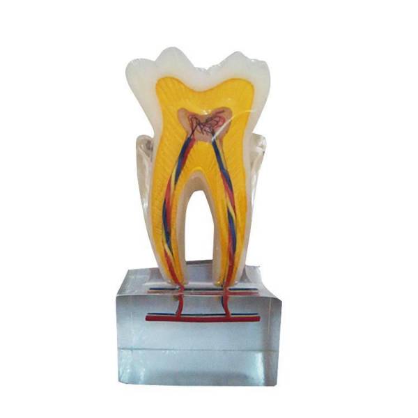 Modelo de anatomía dentaria UM-U14 seis veces normal
   