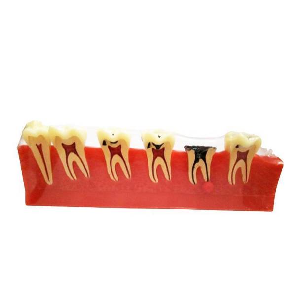 Modelo de clasificación de enfermedades periodontales UM-E8
   