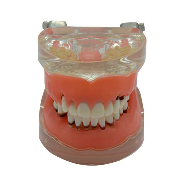 Modelo de enfermedad gingival UM-S9
   