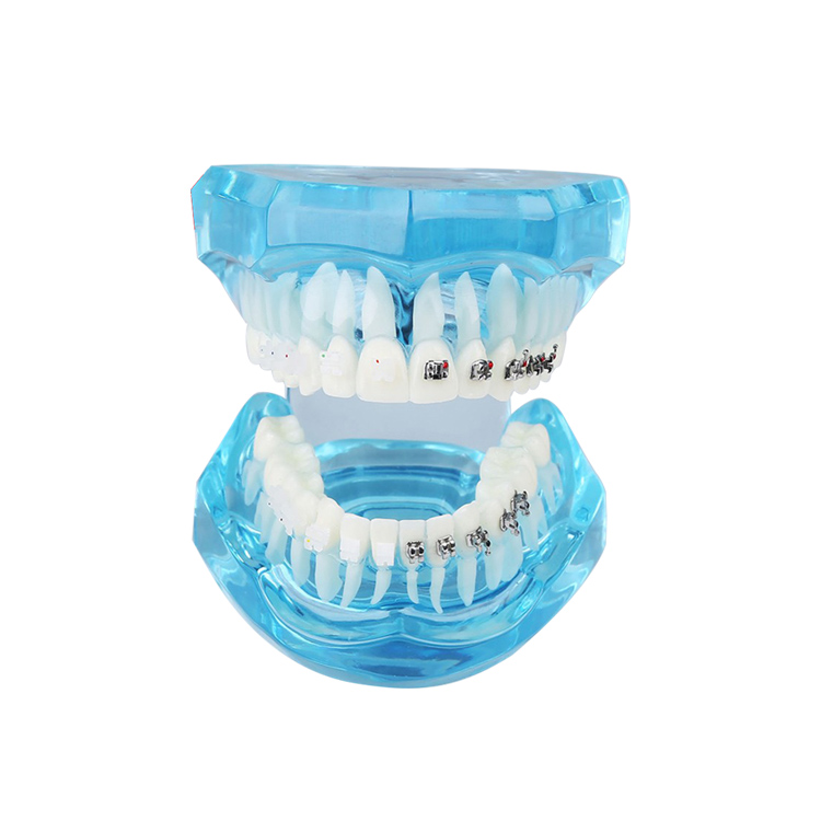 UM-B21 Dentición transparente con brackets
   