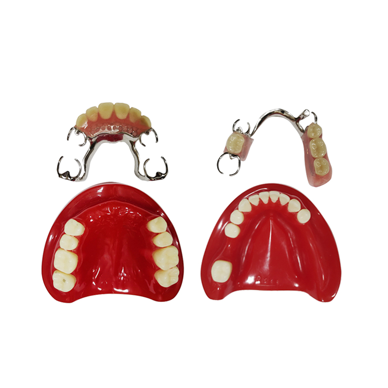 UM-X4 Partially Edentulous Model