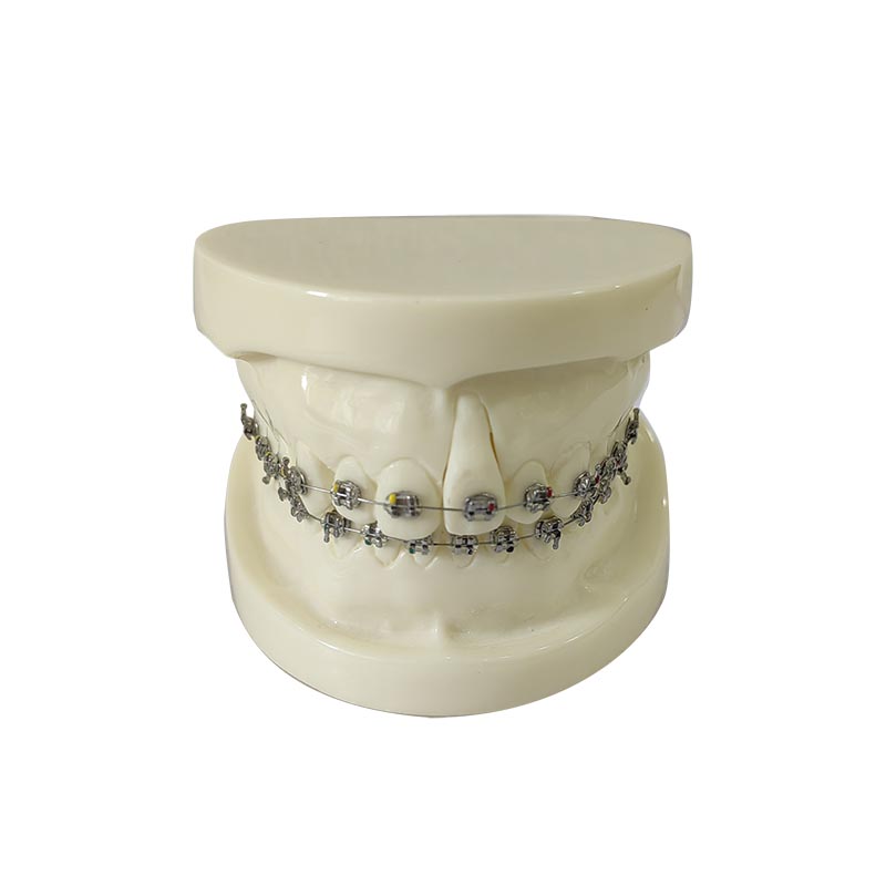 UM-HS10 Orthodontic Model For Demonstration With Edgewise Bracket