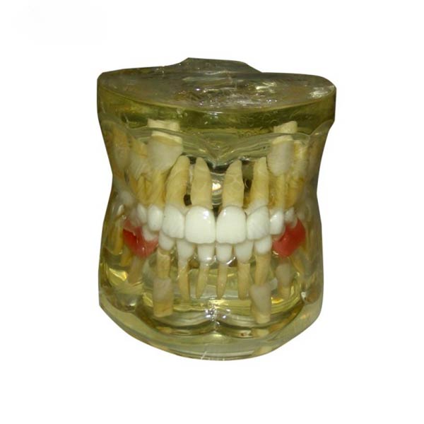 UM-7019 modelo patológico de pérdida temprana de dientes primarios