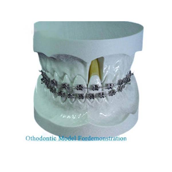 Modelo de ortodoncia UM-S11 para demostración con soporte Edgeise