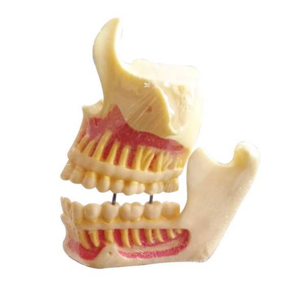 UM-F1 modelos educativos de mandíbula superior y mandíbula