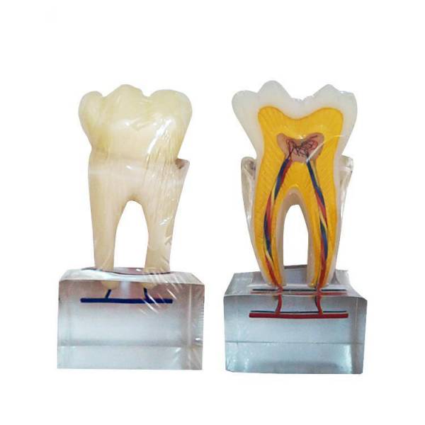 UM-U14 modelo de anatomía del diente normal de seis veces