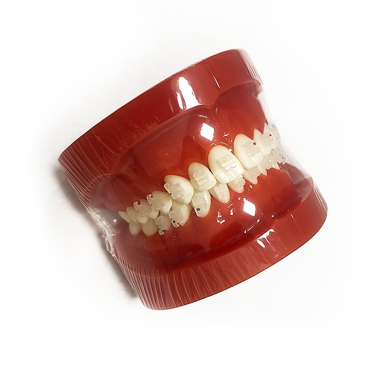 Modelo de ortodoncia UM-B8 (soportes de cerámica)