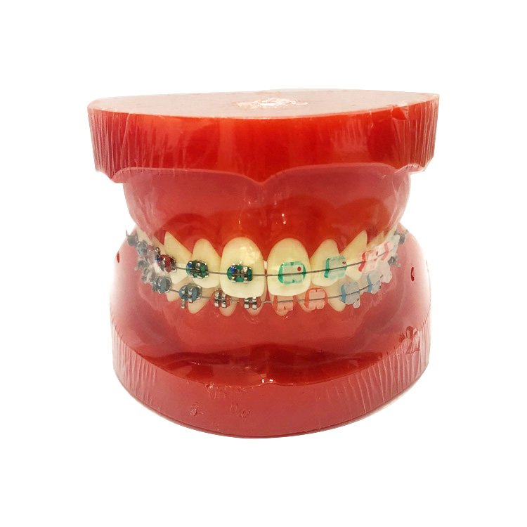 UM-B7 Orthodontic Model (Half Metal And Half Ceremic Brackets)