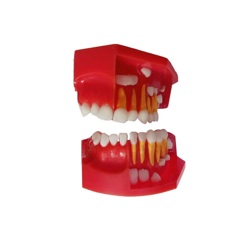 UM-S12A Dentural Development Model A (3-6 Years Old)