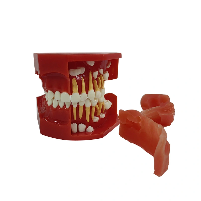UM-S12A modelo de desarrollo dentural A (3-6 años)